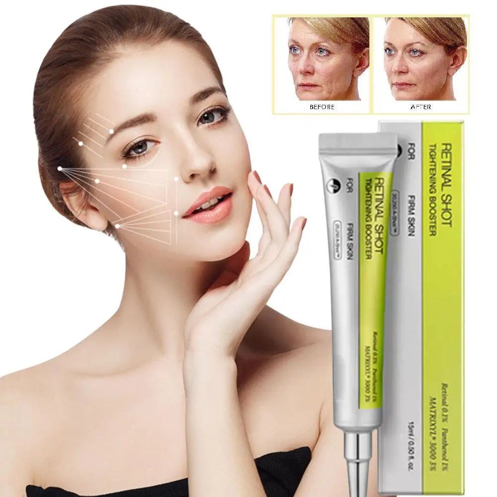 Lavalora™ Retinol Renewal Eye Cream – Brightening & Hydrating Korean Eye Treatment