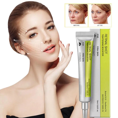Lavalora™ Retinol Renewal Eye Cream – Brightening & Hydrating Korean Eye Treatment