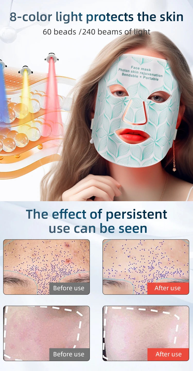 ✨ Lavalora™ 8-Color LED Face & Neck Therapy Mask