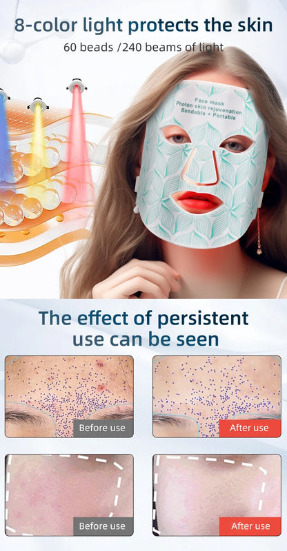 ✨ Lavalora™ 8-Color LED Face & Neck Therapy Mask